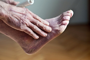 Cold Feet Could Signal Poor Circulation